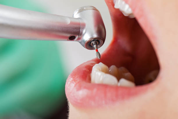 Best Holiday Emergency Dentist in La Paloma, TX